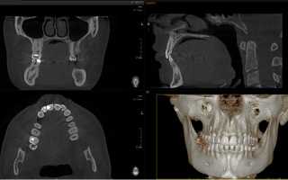 Конусно-лучевая компьютерная томография (КЛКТ) в стоматологии. Цены