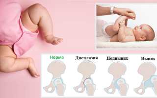 Лягушачий живот у ребенка, новорожденного. Упражнения, как убрать