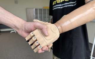 Бионический протез руки. Цены, как работают, где купить, изготовители