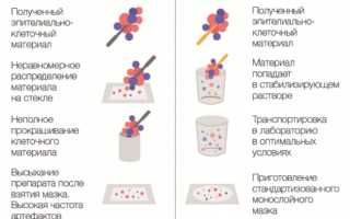 Анализ на цитологию в гинекологии. Что это значит, какие заболевания показывает. Чем отличается от мазка на онкомаркер, сколько делается. Расшифровка