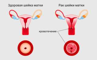 Шейка матки. Фото внутри, строение, норма размеров здоровой при беременности, перед родами, месячными