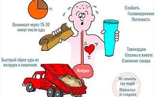 Демпинг-синдром. Что это такое в медицине