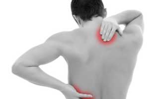 Миозит: симптомы и лечение в домашних условиях