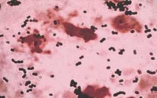Streptococcus Agalactiae (стрептококк агалактия) в мазке у женщин. Что значит, лечение