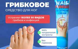 Грибок кожи на ногах, ногтях пальцев. Как выглядит, фото, чем лечить. Мази, народные средства