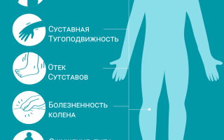 Артрит коленного сустава. Симптомы и лечение, диагностика. Как вылечить ревматоидный, реактивный, подагрический, острый