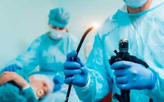 Гастроскопия желудка. Как делают без глотания зонда, под наркозом во сне. Как подготовиться, диета. Что показывает обследование, альтернативы