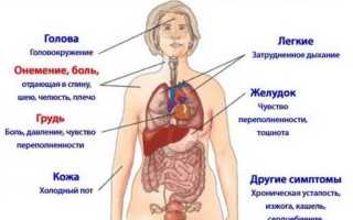 Микроинсульт. Что это, первые признаки, симптомы, последствия и лечение