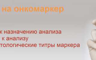 Онкомаркер СА 19-9. Что показывает, означает, норма, как сдавать, расшифровка