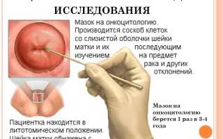 Цитология в гинекологии. Что это такое, виды. Как берут мазок, сколько дней делается, расшифровка