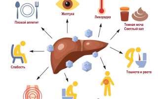 Гепатит А. Как передается от человека к человеку, чем опасен, симптомы и лечение