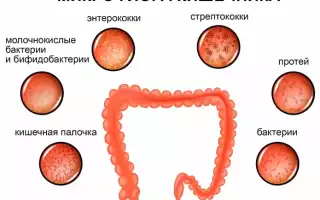 Дисбактериоз кишечника – что это такое, симптомы, лечение у взрослых и детей (у грудничка)