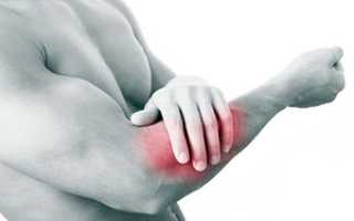 Боль в локтевом суставе при нагрузках или поднятии тяжести