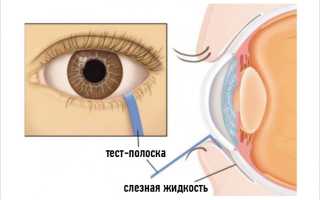 Проба Ширмера в офтальмологии. Что это такое, как проводить, норма