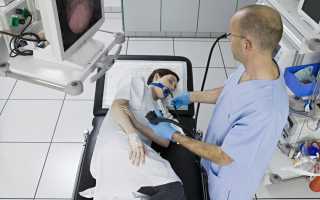 ФГДС под наркозом. Отзывы, как происходит, подготовка, противопоказания