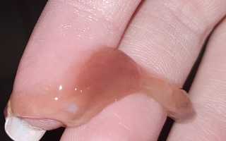 Розовые выделения при овуляции. Норма или патология