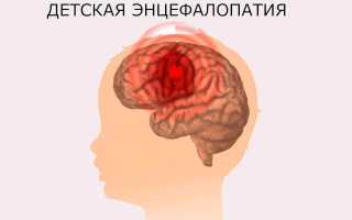 Энцефалопатия неуточненная. Что это такое у детей, грудничка, взрослых, симптомы, последствия