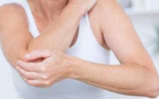 Туннельный синдром локтевого нерва: симптомы, причины, лечение