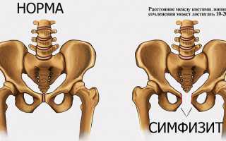 Болит лобок при беременности. Почему сильно болит по неделям