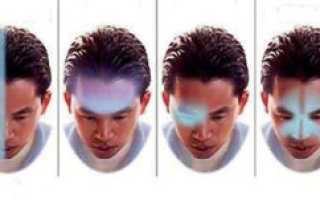 Цефалгия головного мозга, что это такое и в чем проявляется?