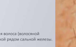 Фурункул под мышкой. Как определить, чем лечить в домашних условиях, стадии развития с фото