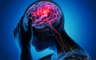 Цефалгия. Что это такое, диагноз у взрослых, синдром, симптомы, лечение