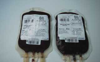 Эритроцитарная масса. Что это, когда применяется, цель, показания