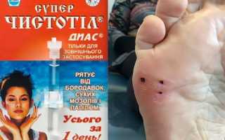 Препараты для лечения шипицы у детей, взрослых, при беременности. Народные средства