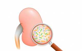 Клебсиелла пневмония. Что это такое в моче, мазке из зева, кале, симптомы, степени, лечение