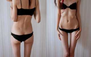 Анорексия у подростков мальчиков и девочек. Признаки, что делать, причины и лечение