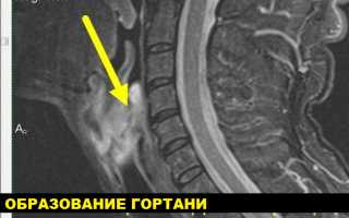 МРТ горла и гортани, глотки, пищевода. Что показывает, цена