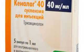 Противовоспалительные уколы при болях в спине, пояснице, остеохондрозе