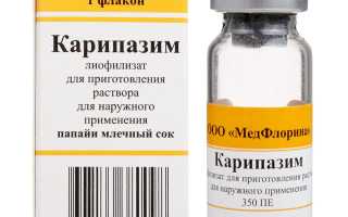 Карипазим при грыже позвоночника. Отзывы, цена