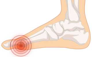 Болит палец на ноге большой. Причины, суставы, ногти, косточка, подушечки при ходьбе