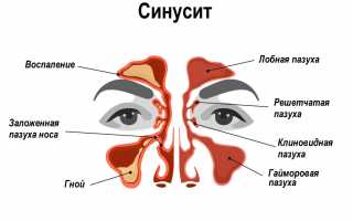 Ночной кашель. Причины и лечение у взрослого, как остановить
