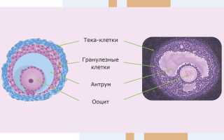 Персистенция фолликула правого яичника. Что это такое