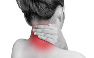 Болит шея сзади, слева, справа, сбоку. Причины, чем лечить