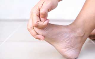 Немеют пальцы ног: на левой, правой, большой. Почему, что это значит, причины и лечение