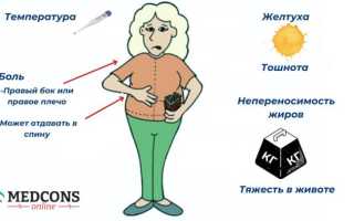 Желчный пузырь. Симптомы заболеваний, диагностика и лечение. Препараты, народные средства, диета