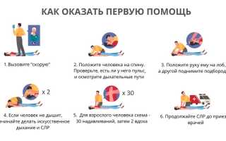 Сердечно-легочная реанимация. Что это такое, показания, алгоритм проведения, клинические рекомендации