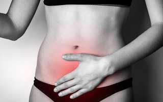 Боли в животе при месячных сильные, тянущие, резкие. Таблетки, чем обезболить, как избавиться