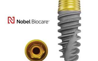 Импланты Nobel Biocare. Производитель, цена под ключ, отзывы