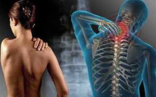 Что такое фибромиалгия, симптомы и лечение этого заболевания