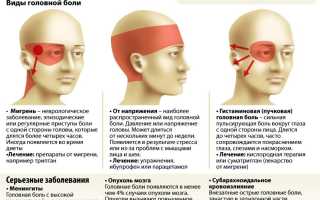 Боль в висках пульсирующая, в затылке, глазах: причины и лечение