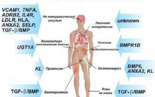 Серповидноклеточная анемия. Что это такое, причины, симптомы и лечение, тип наследования