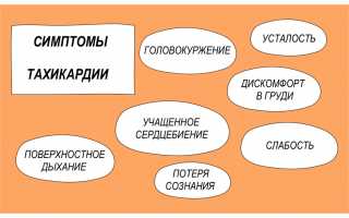 Тахикардия сердца. Причины возникновения, симптомы и лечение