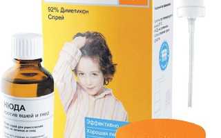 Народные средства от вшей и гнид для детей, взрослым, беременным с уксусом. Что добавить в шампунь