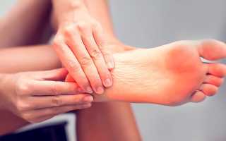 Болят пятки при ходьбе, больно наступать. Причины, чем лечить кожу стоп в домашних условиях