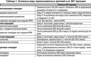 Вагусные пробы при тахикардии, аритмии, экстрасистолии, ВПВ у взрослых. Что это такое, противопоказания
