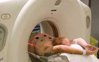 КТ (компьютерная томография) сердца и коронарных сосудов. Как делается, цена